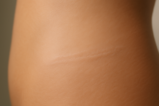 Beyond Hanafy: Why Nue Pigment N6 is the Superior Choice for Scar & Stretch Mark Camouflage