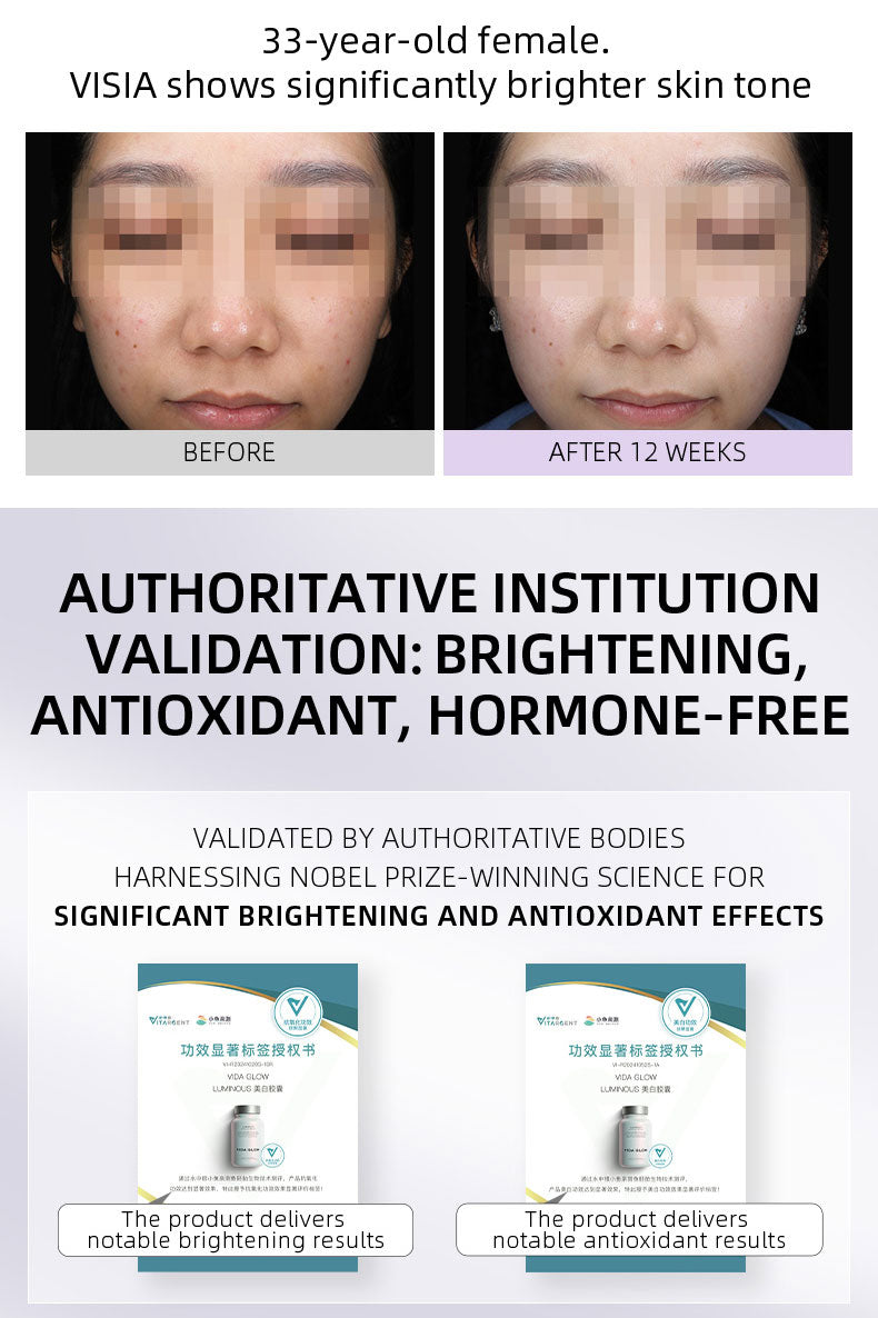 【Member Upgrade】Vida Glow Luminous Capsules 30 capsules*4 bottles Free SGD9 voucher pack