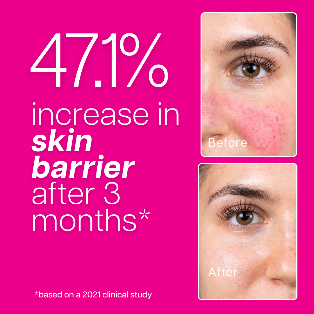 Ventamin Collagen Party Daily Collagen Supplement for Firmer Skin