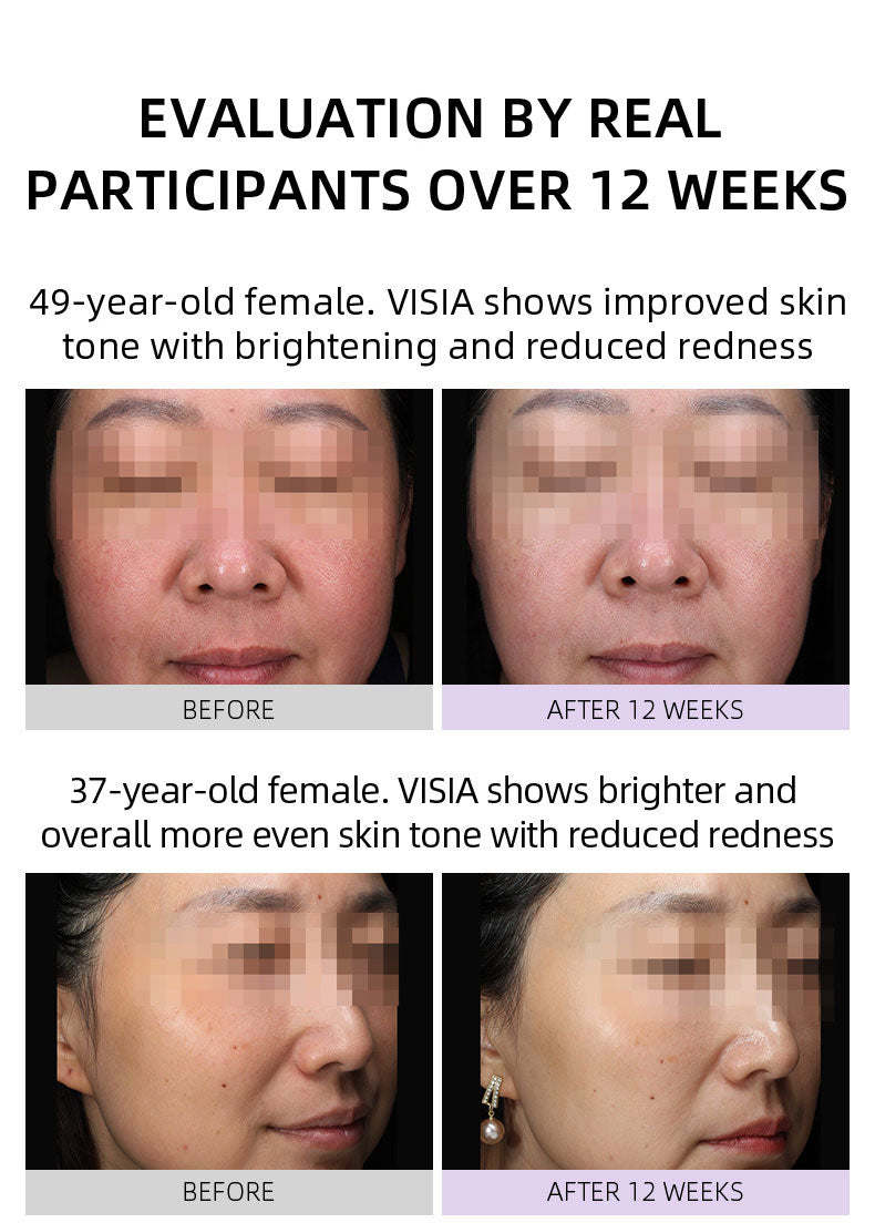 【Member Upgrade】Vida Glow Luminous Capsules 30 capsules*4 bottles Free SGD9 voucher pack