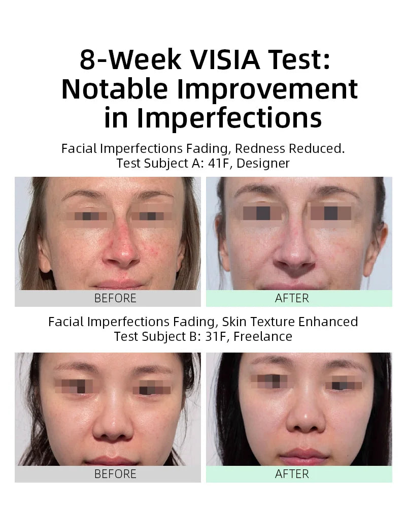 【Member Upgrade】Vida Glow Radiance+*3 bottles+Collagen Liquid Advance/Marine Collagen*3 packs Free SGD9 voucher pack