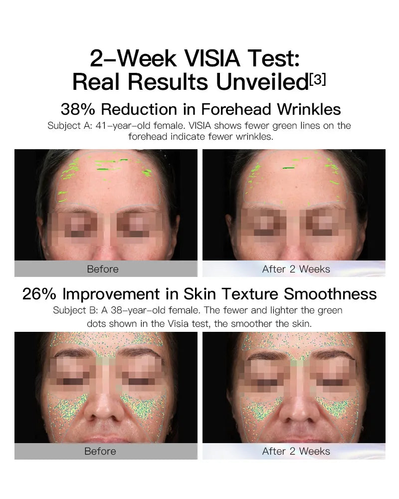 【Member Upgrade】Vida Glow Pro Collagen+*4 + Collagen*6 sachets Free SG