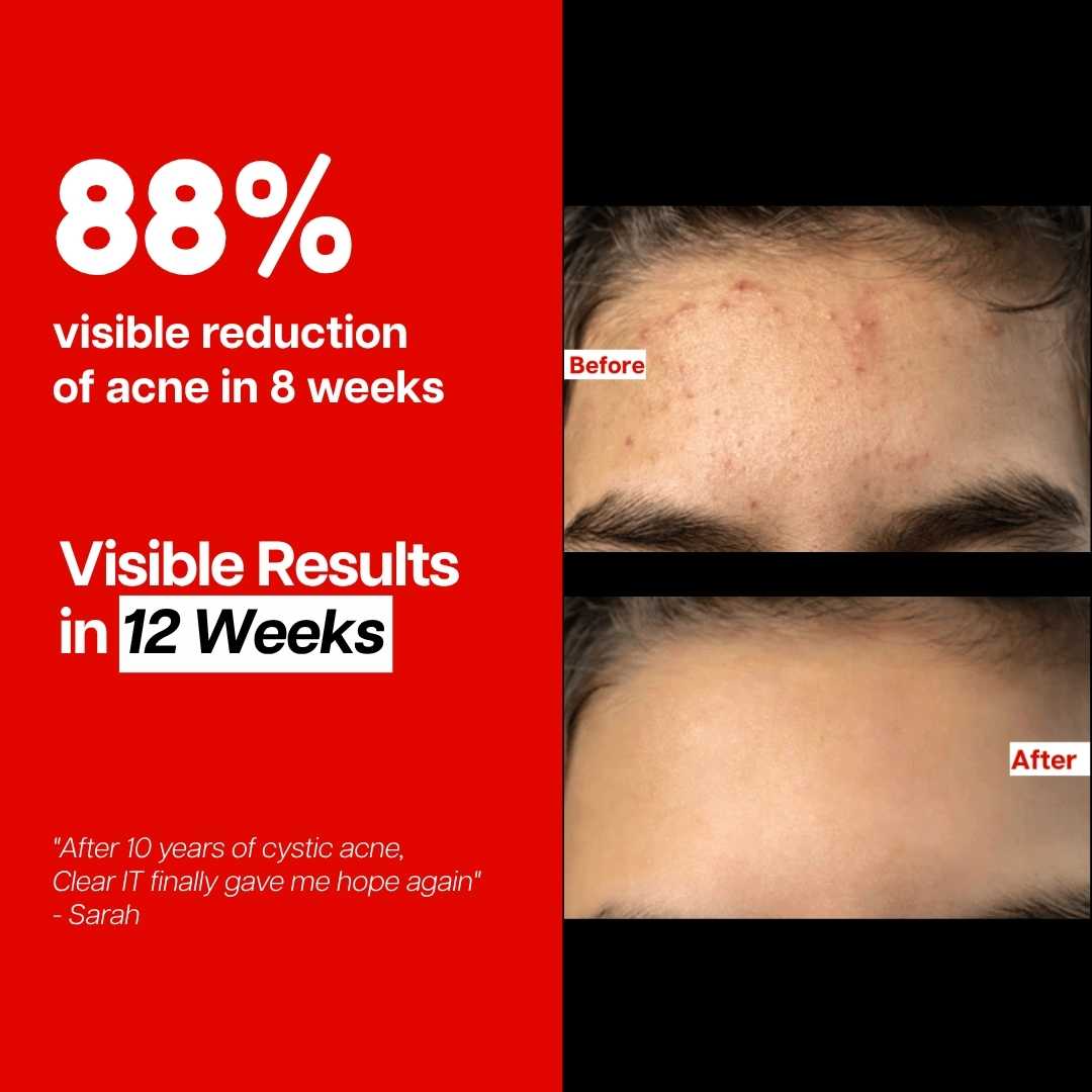 Ventamin Clear It Daily Skin Support Supplement for Clearer Looking Skin