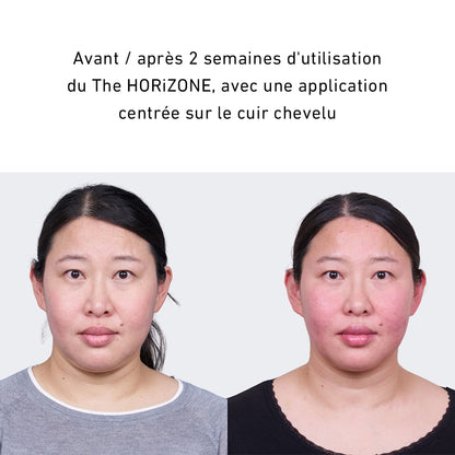 HORiZONE