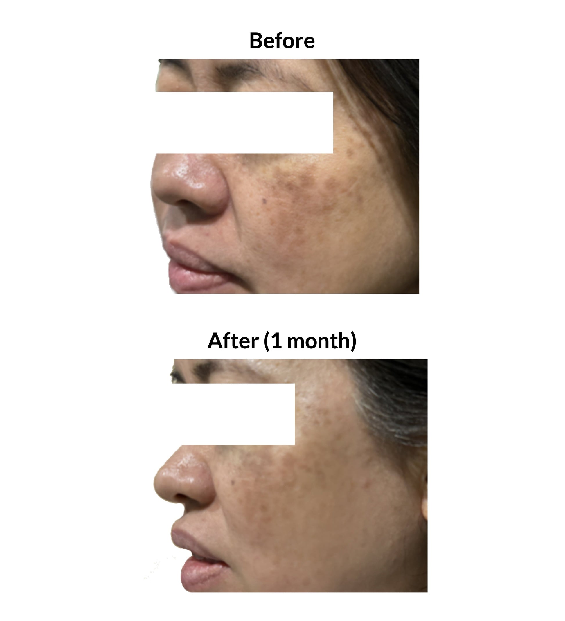 Illuminate Nutri Serum Concentrate for Skin Brightening and Even Tone 30ml