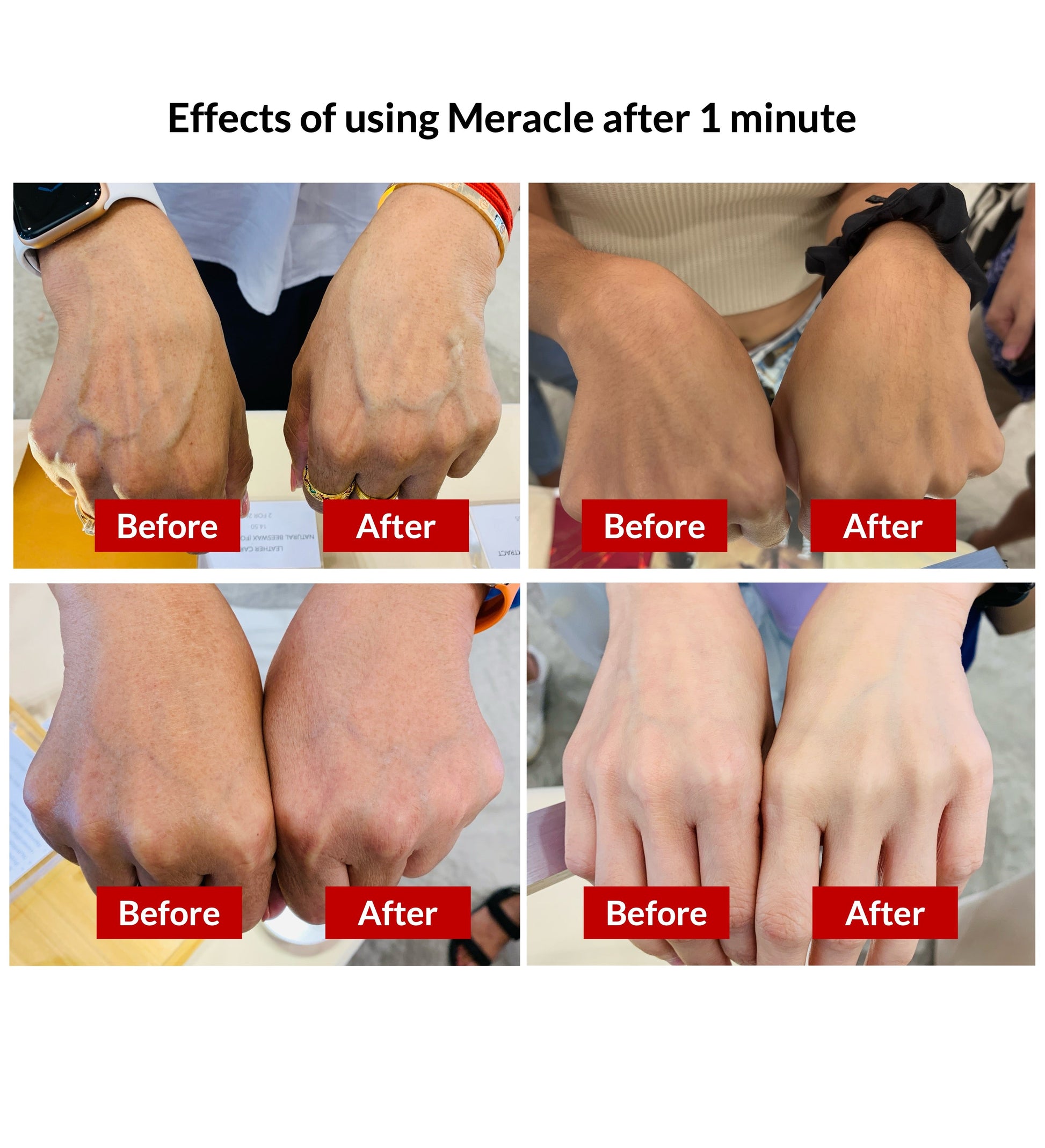 Meracle Nutri Essence Treatment Enhancer for Skin Brightening and Hydration 50ml