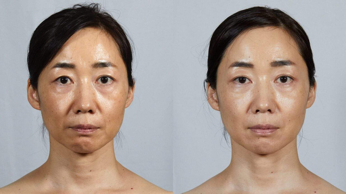 Face Player II