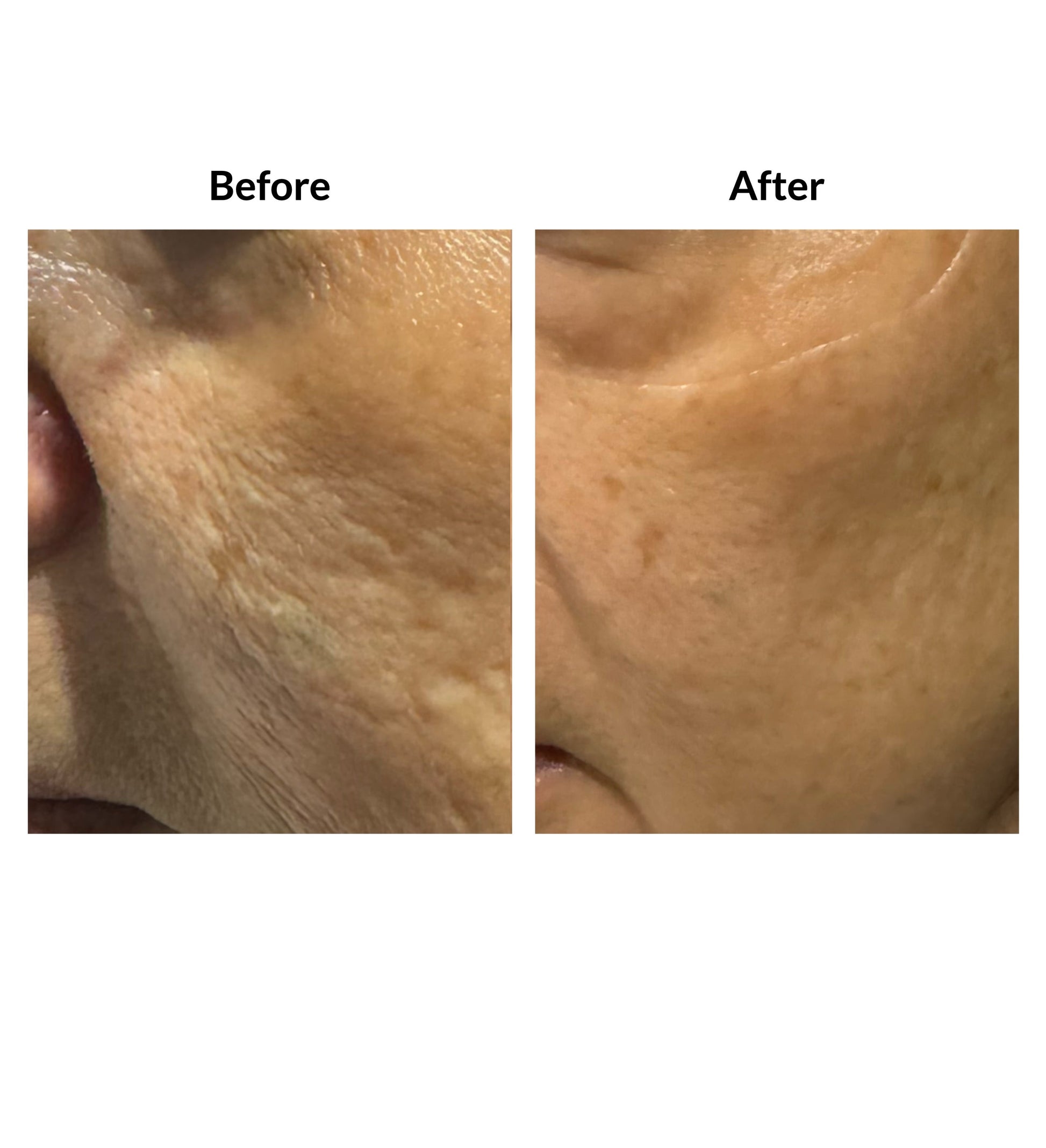 Rejuvenate Nutri Serum Concentrate for Skin Renewal Hydration and Firmness 30ml
