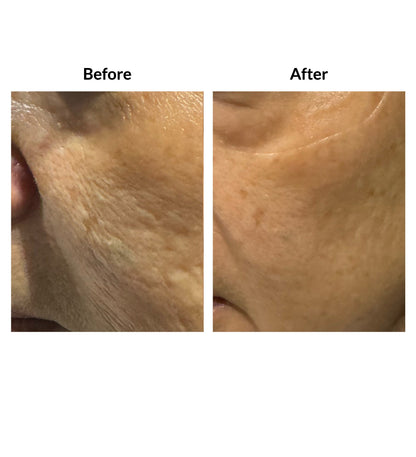 Rejuvenate Nutri Serum Concentrate for Skin Renewal Hydration and Firmness 30ml