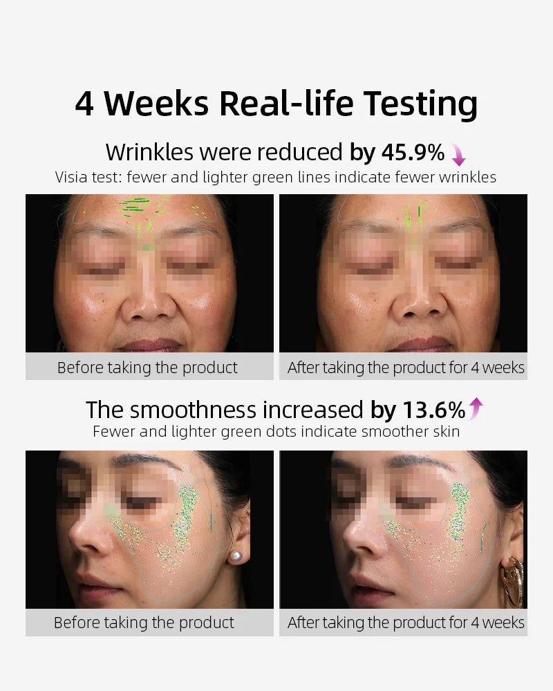 【Member Upgrade】Vida Glow Collagen Liquid Advance 15 sachets*7 packs