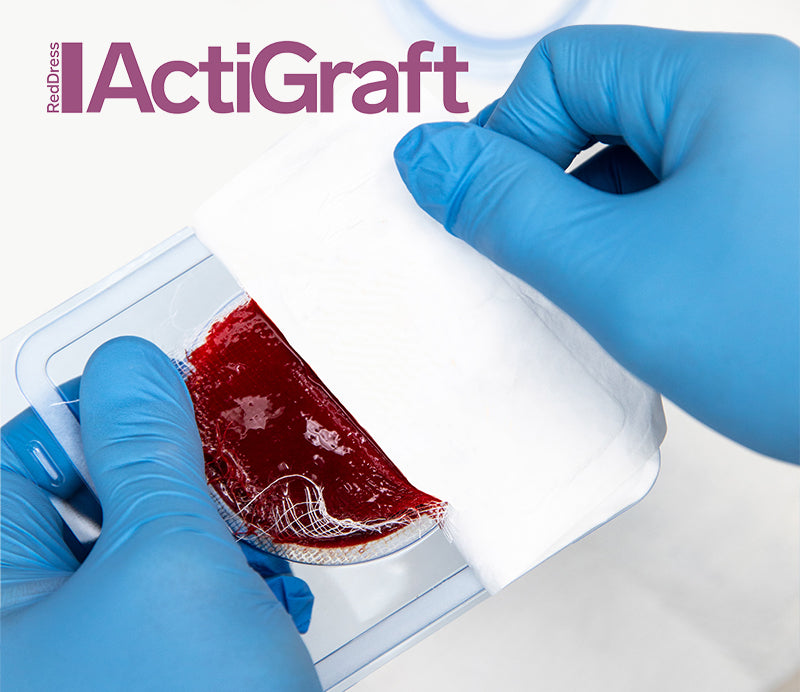 RedDress’s ActiGraft® Technology Autologous Blood Clot Therapy for Chronic Wound