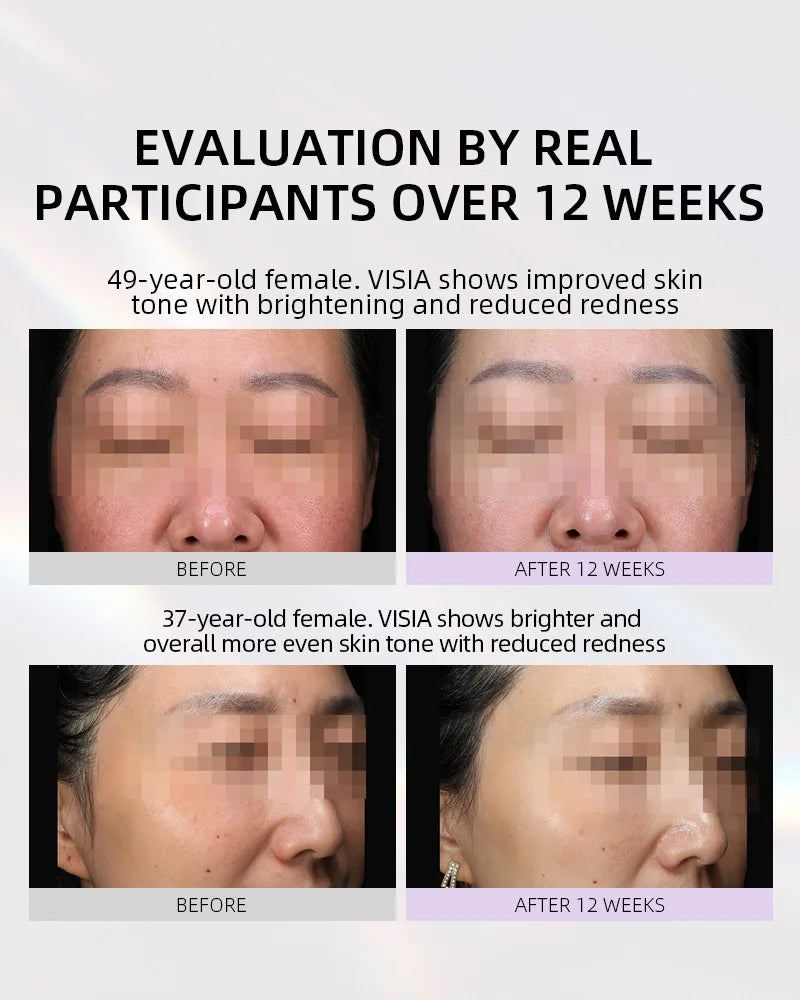 【Member Upgrade】Vida Glow Luminous Capsules 30 capsules*4 bottles Free SGD9 voucher pack