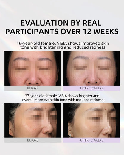 【Member Upgrade】Vida Glow Luminous Capsules 30 capsules*4 bottles Free SGD9 voucher pack