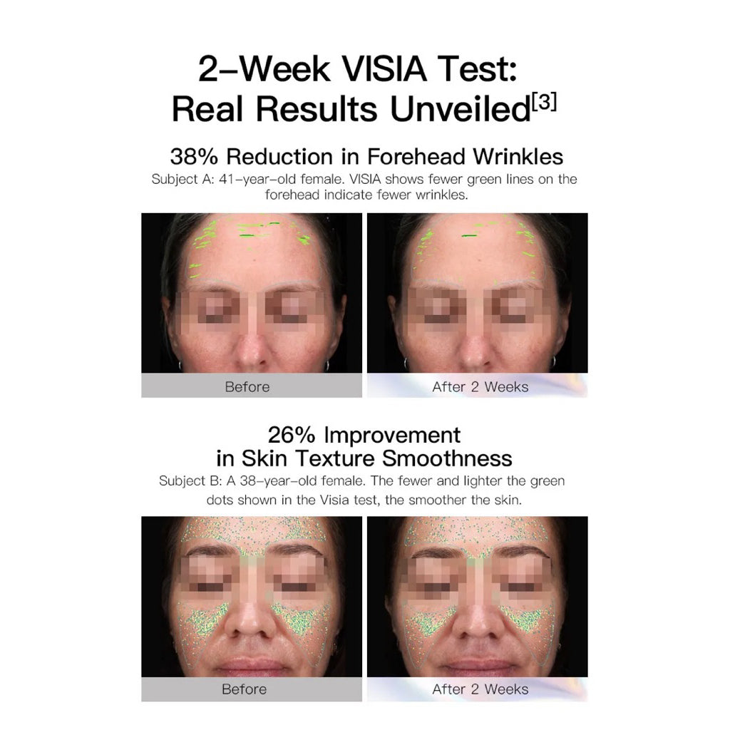 [Australia] Vida Glow Pro Collagen + 30 Sachets